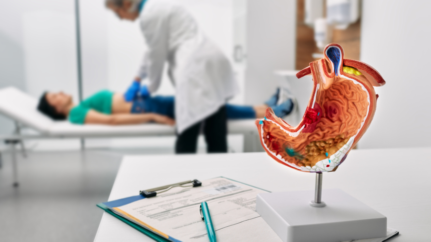 Magsår: orsak, symtom & behandling