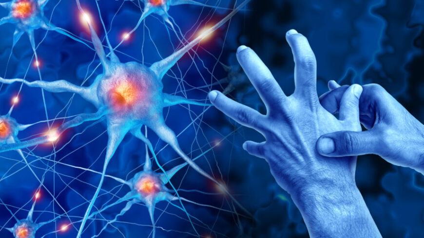 Parkinsons sjukdom uppstår när nervceller i hjärnans område substantia nigra bryts ned. Vanliga motoriska symtom är skakningar, muskelstelhet och långsamma rörelser. Foto: Shutterstock