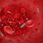 Sepsis (blodförgiftning): symtom, orsaker & behandling