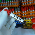 Hypotyreos: orsak, symtom & behandling