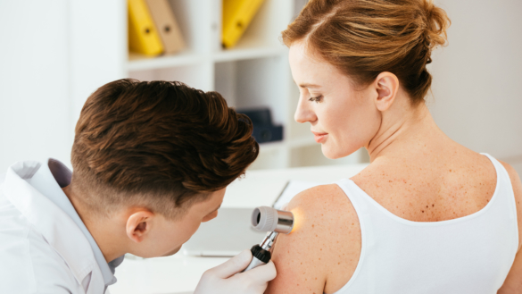 Hudcancer ökar i södra Sverige