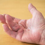 Vikingasjukan ett arv efter neandertalare