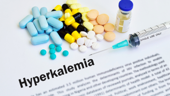 Högt kalium: orsak, symtom & behandling