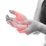 Domningar (klämda nerver, nervstörning): symtom, orsak & behandling