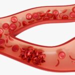 Sicklecellanemi (SCD): symtom, orsaker & behandling