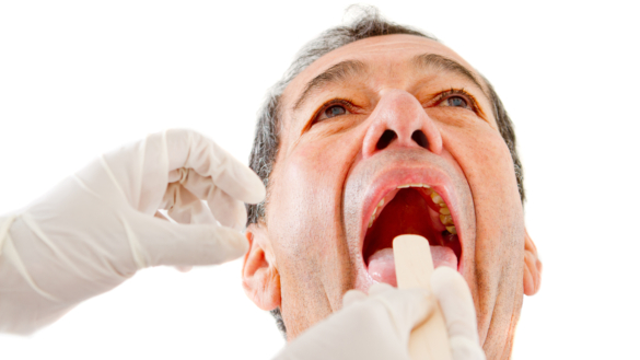 Halsböld (peritonsillär abscess): orsak, symtom & behandling