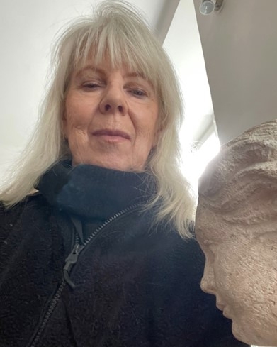 Addisons sjukdom – en tuff, kronisk sjukdom