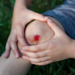 Infekterade sår: orsak, symtom & behandling