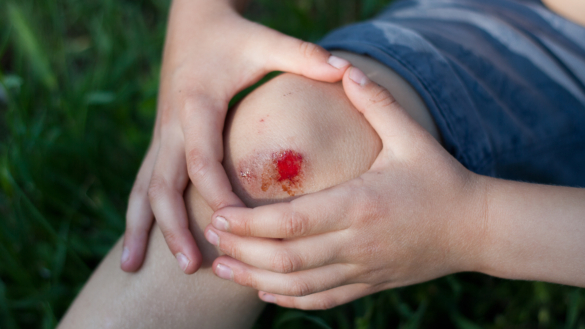 Infekterade sår: orsak, symtom & behandling