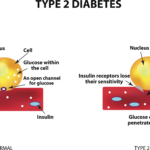 Diabetesläkemedel ökar inte risk för sköldkörtelcancer