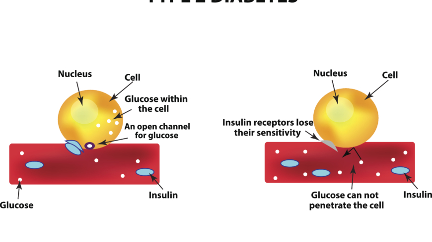 Diabetesläkemedel ökar inte risk för sköldkörtelcancer