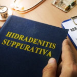 Hidradenitis Suppurativa (HS): orsak, symtom & behandling