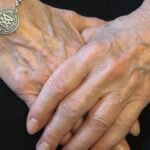 Addisons sjukdom: att åldras med sjukdomen