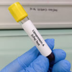 Ny blodanalys förbättrar riskbedömning av hjärt-kärlsjukdom