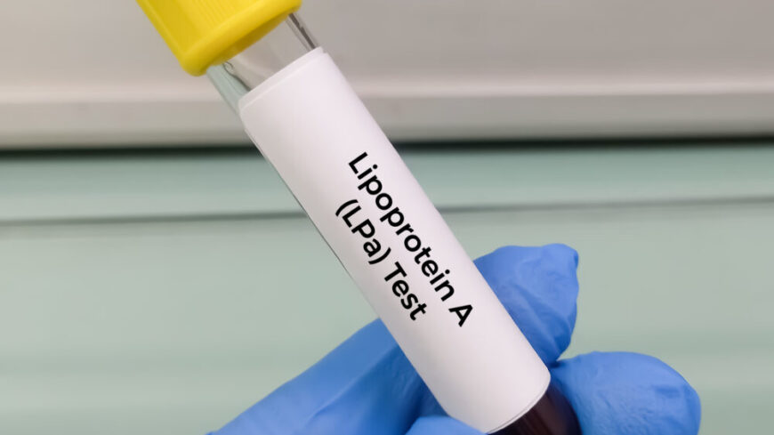 Ny blodanalys förbättrar riskbedömning av hjärt-kärlsjukdom