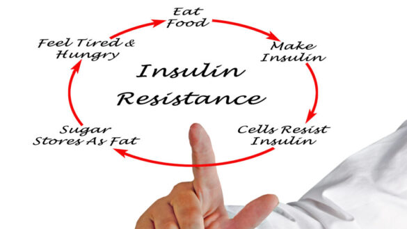 Insulinresistens: orsak, symtom & behandling