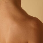 Från topp till tå: kort om huden