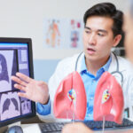 Lungcancer ökar bland icke-rökare