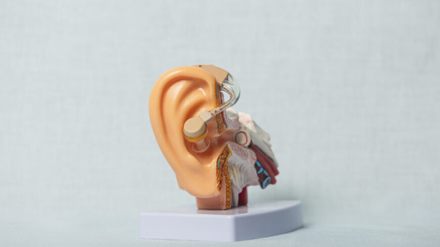 Otoskleros – orsak, symtom & behandling