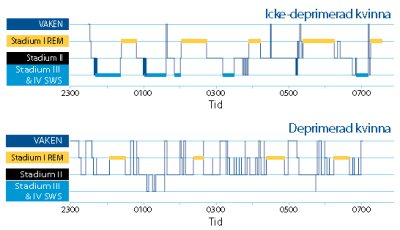 Nytt läkemedel mot depression ställer in dygnsrytmen
