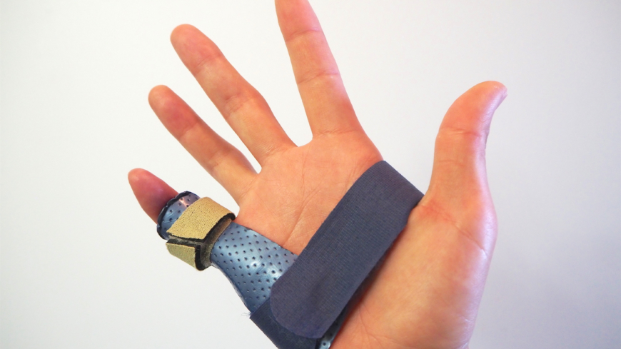  En fraktur i fingret som engagerar leden kan efter gipsperioden behöva ytterligare behandling en tid med en ortos. Foto: Shutterstock