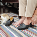 Ödem (svullna ben & fötter): orsak, symtom & behandling