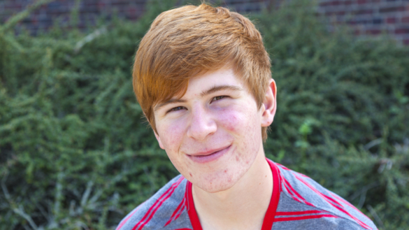 Aknemedel får tillbaka subvention