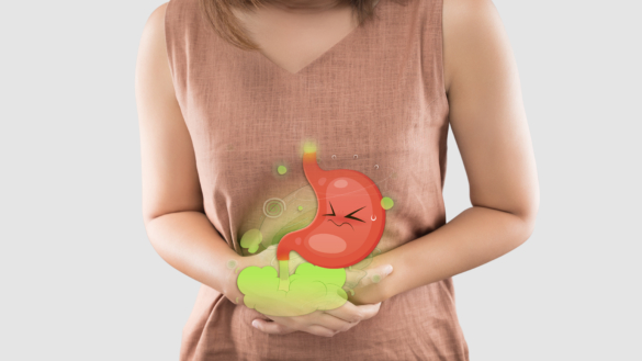 Har du IBS? Gör IBS-testet!