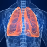 Lungfibros (idiopatisk): orsak, symtom & behandling