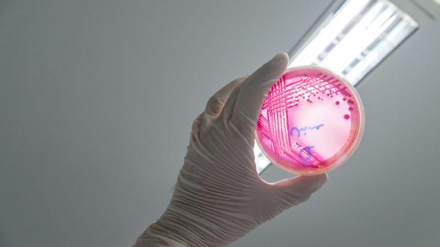 EHEC är en potentiellt mycket allvarlig infektion, som dock kan förebyggas med god hygien.  Foto: Shutterstock