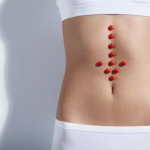 Webb-TV: Inflammatorisk tarmsjukdom – Ulcerös kolit