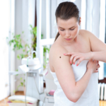 Hudcancer: orsak, symtom & behandling