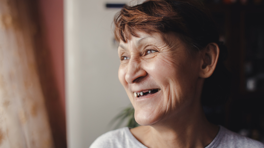 Forskarna fann ett direkt orsakssamband mellan karies och kardio-metabola riskfaktorer rökning, övervikt, utbildning och personlighet. Foto: Shutterstock