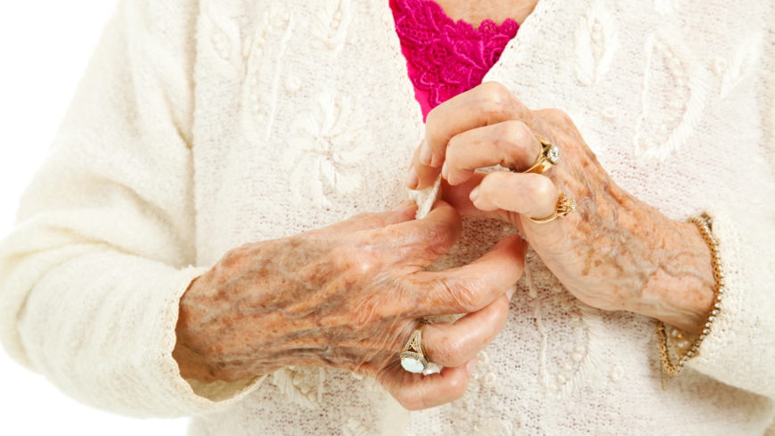 Webb-TV: Bra att veta om artros